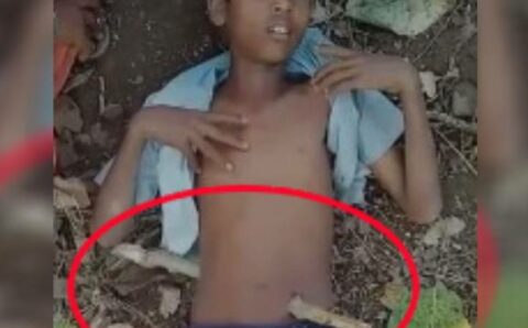 खेल-खेल में पेड़ से गिरा लड़का, पेट से आरपार हुई नुकीली लकड़ी,इसके बाद जो हुआ….