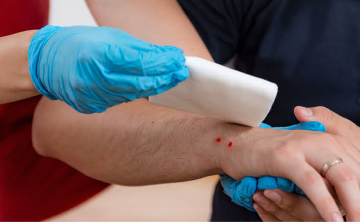 झाड़-फूंक से नहीं, इलाज से बचती है जान – सांप काटे तो तुरंत जाएं अस्पताल…